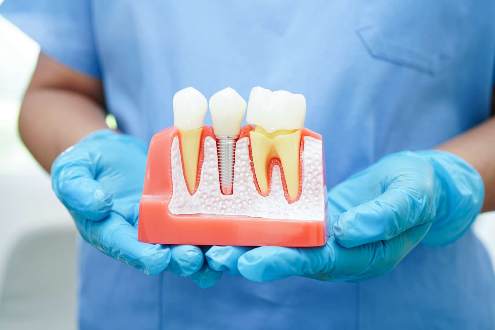 Tooth Repair at KLT Dentistry