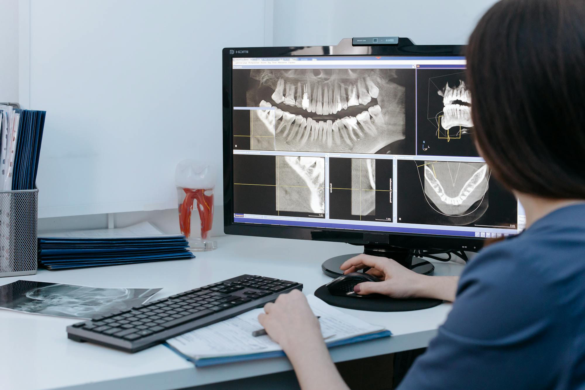 KLT dentistry implant Restorations